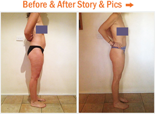 Before & After Story & Photos...